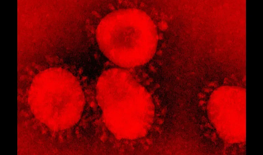 Imagen microscópica de un coronavirus.